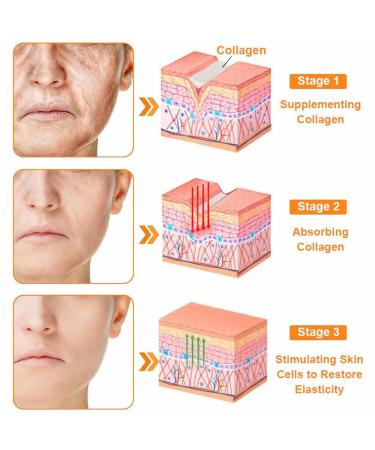 Bee Venom skin Restoration Cream Bee Venom Skin Treatment Cream Deeply cleanses and moisturizes the skin effectively reducing blemishes (1PC) - Buy Online on GoSupps.com