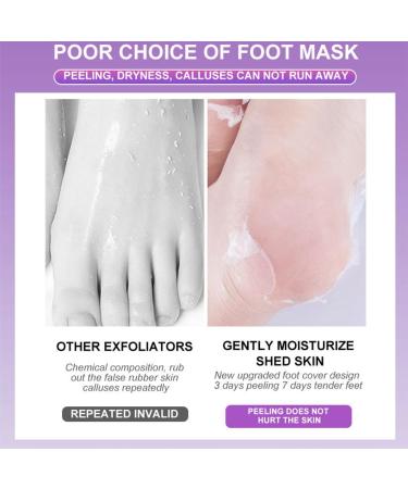 3Pairs Foot Peel Mask Foot Care Exfoliating Foot Peeling Mask for Dead Skin Exfoliating Socks Foot Mask Moisturizing Feet Peeling Mask for Dry Skin Skincare Socks for Women Foot Spa Peeling Foot Mask - Buy Online on GoSupps.com