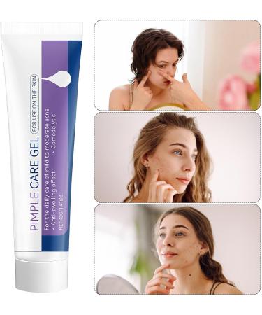 Anti-blemish gel soothes and refreshes the skin 40g facial repair treatment blemish remover gentle formula for daily use under makeup after cleansing - Buy Online on GoSupps.com