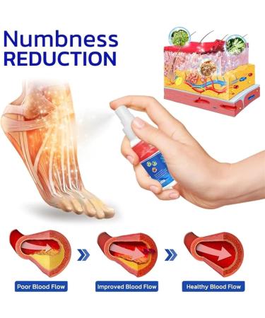 Numbfix Hand and Foot Spray - Relief for Joint Pain & Denosynovitis | 1 Piece | Fast International Shipping - Buy Online on GoSupps.com