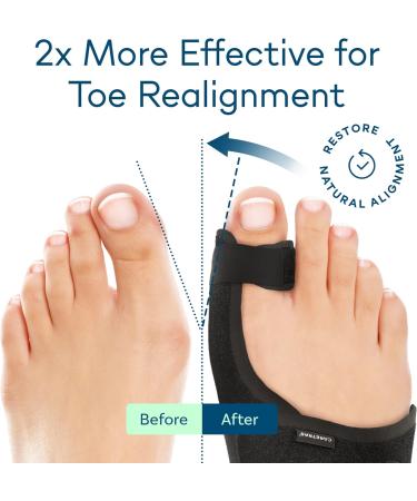 Bunion Corrector & Toe Spacer Bundle for Day and Night Relief - Buy Online on GoSupps.com