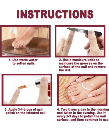 Extra Strong Fungal Nail Treatment - Nail Fungus Remover Kit with File and Brush - 20ml - Buy Online on GoSupps.com