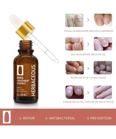 Anti Fungal Nail Treatment | Severe Fungal Nail Treatment | Premium Fungal Nail Destroyerfor Toenails Extra Strong | 30ML (2 Bottle) - Buy Online on GoSupps.com