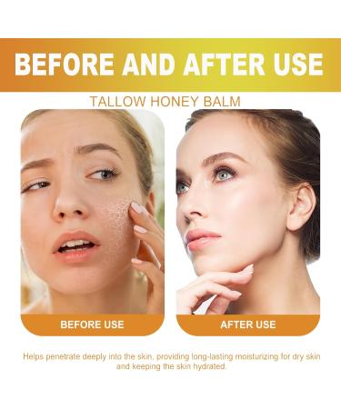 QUEEN Beef Tallow Honey Balm Organic Grass Fed Tallow Balm Deep Nourishing Beef Tallow Skin Care for Face and Body Sebum Cream 100 Grass Fed Beef Tallow Moisturizer for - Buy Online on GoSupps.com