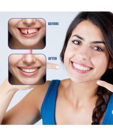 Natural False Tooth To Place 2 Pairs Cosmetic Dental Prosthesis Perfect Smile Denture Upper And Lower Temporary Dental Appliance For Men And Women With Bad Teeth - Buy Online on GoSupps.com