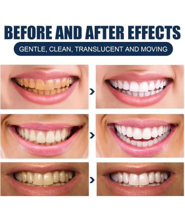 Fortbite Tooth Powder Fortbite Toothpaste Teeth Cleaning Powder Teeth Whitening Powder Stain Removal for Healthy Teeth and Gums (1pcs) - Buy Online on GoSupps.com