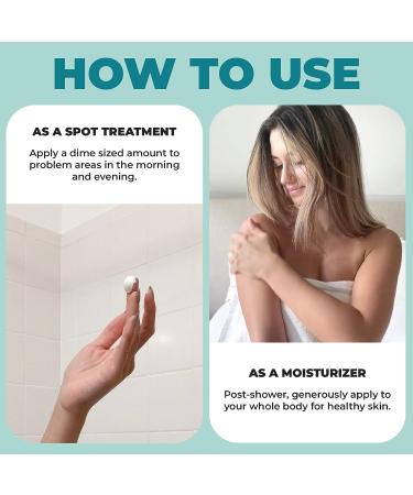 Miami Beach Bum Mint Bum + Body Cream 6oz - Daily Moisturizer for Skin Health, Acne Treatment, Razor Bumps, Ingrown Hairs, Sunburns, Blemishes - After Sun Lotion - Buy Online on GoSupps.com