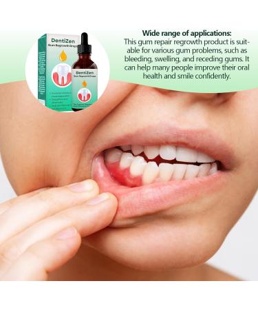 Manolyee Teeth Gum Repair | Liquid Gum Relief for Oral Gum Care 1.01oz - Natural Oral Care Drops for Regrowth - Buy Online on GoSupps.com