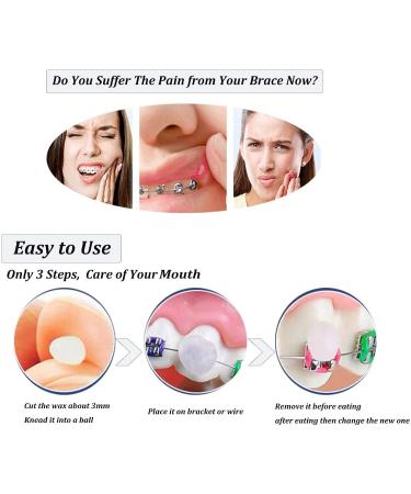 Wenplus 10 Pack Dental Wax for Braces - Mint Fragrance Blue | Orthodontic Oral Care Solution - International Shipping Available - Buy Online on GoSupps.com