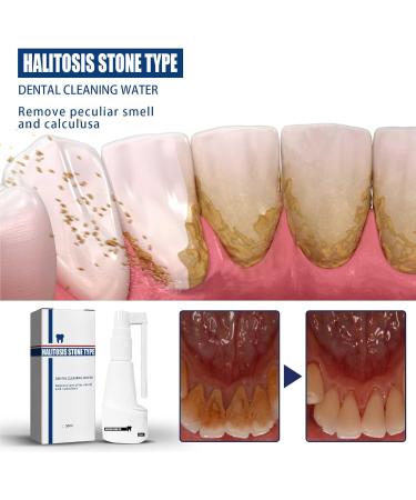 Ultimate Tooth Whitening Spray | Remove Tartar & Yellow Stains - Fresh Breath & Bright Smile - Buy Online on GoSupps.com