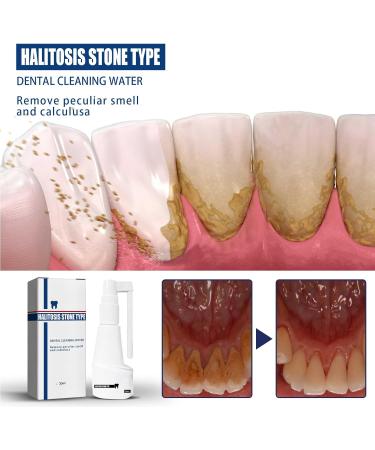 Tooth-Up Mouth Spray | Tartar Remover & Tooth Cleaning Spray | Protect Oral Hygiene - 30ml - Buy Online on GoSupps.com