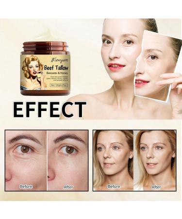 120g Organic Tallow Balm & Honey Balm - Wrinkle Defense Cream for Face & Body | Pure Moisture Skin Care - Buy Online on GoSupps.com