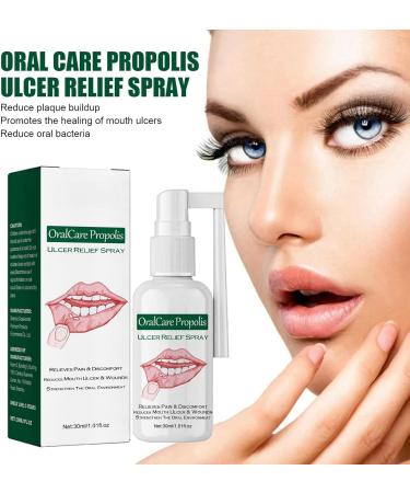 Mouth Ulcer Treatment Spray Mouth Ulcer Spray Canker Sore Treatment for Adults Oralcare Propolis Ulcer Relief Spray Herbal Mouth Spray Canker Relief Spray Breath Spray for Bad Breath Breath Freshener - Buy Online on GoSupps.com