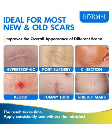 BORMSI Scar Cream Silicone Advanced Scar Treatment Gel - Repair Surgical Scars, Keloids, Stretch Marks, Acne - 1.76oz(50G) White - Buy Online on GoSupps.com