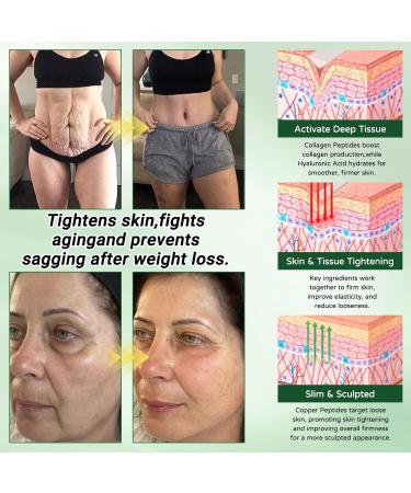 Finndeen Moringa 10-in-1 Advanced Nano Microdarts Patch 2026 New Natural Moringa Patche Body Skin Care Slim Patches for Women and Men - Body Slim Patches for All Skin Types (2 boxes) - Buy Online on GoSupps.com