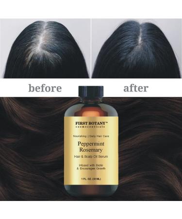 Peppermint Rosemary Hair Growth Serum with Biotin - Nourishing Treatment for Split Ends & Dry Scalp - Fights Hair Loss - 1 fl oz - Buy Online on GoSupps.com