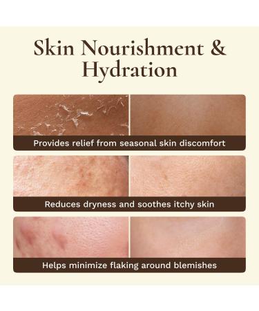 Organic Beef Tallow for Skin Face - Tallow and Honey Balm for Face - Whipped Grass-Fed Moisturizer with Raw Honey & Beeswax - Hydrating Body Cream for Dry Cracked and Sensitive Skin 4 Fl Oz (Pack of 1) - Buy Online on GoSupps.com