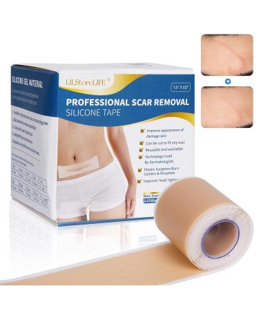 Professional Silicone Scar Sheets Roll - 60 x 1.6 Inches | Reusable Treatment for Keloid, C-Section, Surgery & Acne Scars - Buy Online on GoSupps.com