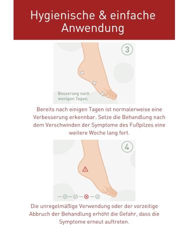 N1 Foot Fungus Spray 75ml | Fast Relief for Itching & Redness | Medical Foot & Skin Fungus Treatment - Buy Online on GoSupps.com