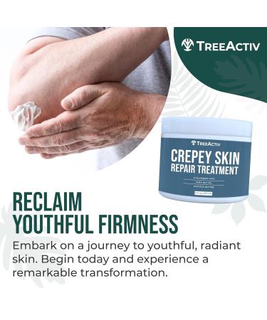TreeActiv Crepey Skin Repair Treatment - Firming Cream with Hyaluronic Acid for Face & Neck | 8 fl oz | Moisturizing Lotion for Dry Crepey Skin - Buy Online on GoSupps.com