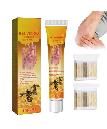 KCRPM Youth Bee Venom Psoriasis Treatment Cream New Zealand Bee Venom Professional Psoriasis Treatment Cream Soothing and Moisturizing Psoriasis Cream for All Skin Types (1pcs)