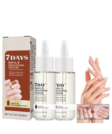 2Pcs Recuperative Nail Repairing Serum 7 Days Nail Growth and Strengthening Serum Nail Cuticle Oil Strengthener Nail Repair Solution for Damaged Nails