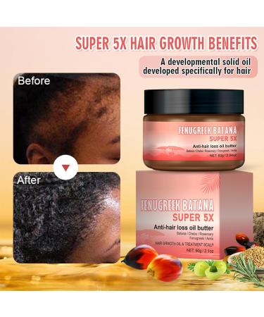 Batana Oil Pure Batana Oil for Hair Growth Super 5X Veganic Natural Hair Growth Oil Repair Damaged Hair & Skin Effective Against Regional Alopecia Promote Hair Regrowth - 60ml - Buy Online on GoSupps.com