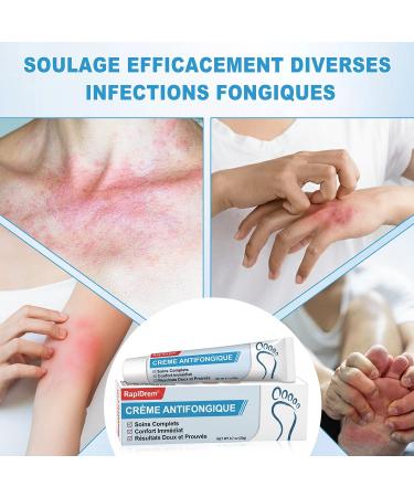 Cr me Antifongique 20 g - Cr me antifongique pour la peau soin quotidien pour la peau sujette la mycose pied - Buy Online on GoSupps.com