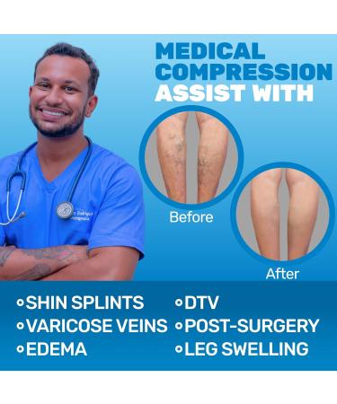 Absolute Support Opaque Compression Stockings for Men & Women - Class 2 20-30 mmHg | Ideal for Varicose Veins Swelling Lymphedema Lipedema | Beige 6XL - Buy Online on GoSupps.com