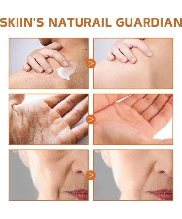 Moisturiser for Dry Skin - Tallow Honey Balm Body Lotion - Body Moisturiser for Hydrating Nourishing Repairing Firming - Body Cream Suitable for Whole Body - Body Skin Care - Buy Online on GoSupps.com