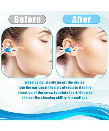 Q Grips Spiral Earwax Removal Tool Kit - Reusable & Safe Ear Cleaner with 16 Soft Heads - For Adults & Kids (Light Blue) - Buy Online on GoSupps.com