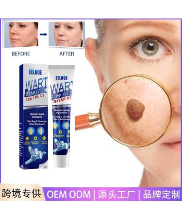 Maximum Strength Wart Ointment - Fast-Acting Wart Gel Cream with Salicylic Acid for Genital Plantar Common and Flat Warts - Effective Wart Freeze Off Solution - Buy Online on GoSupps.com