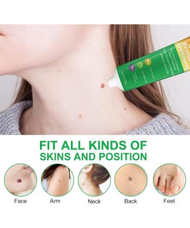 Skin Tag & Wart Remover Cream - Advanced Treatment Formula, Natural Ingredients - 20g - Buy Online on GoSupps.com