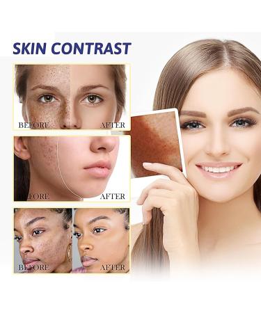 IZBEAUVO Dark Spot Correcting Face Cream Dark Spot Remover For Face and Body Freckle Removal Cream Pigmentation Removal Cream Removal Melasma Cream for Age Spot Sun Spots and - Buy Online on GoSupps.com
