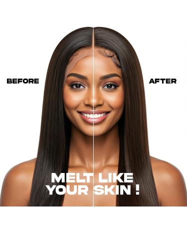 Lace Melt Spray - Supreme 3.39 fl.oz./100ml | Flawless Natural and Seamleass Finish No Reside Long Lasting Formula with Protecting Edges Perfect for Wigs 3.39 fl.oz./100ml Supreme - Buy Online on GoSupps.com