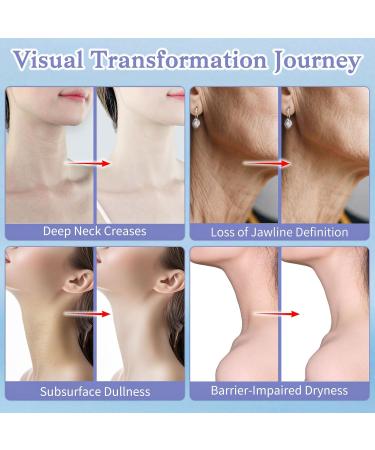 Anti-Aging Neck Firming Cream - Natural Face Moisturizer with Retinol Collagen Peptides & Hyaluronic Acid - Daily Moisturizer Face & Neck Cream - Firming Hydrating Facial Moisturizer Cream Day & Night - Buy Online on GoSupps.com