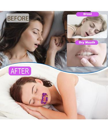 Mouth Tape For Sleeping Quit Mouth Breathing Device Anti Snoring Promotes Nasal Breathing Adhesive Non Woven Fabric Cute Pattern Large Size For Adults 30 Sheets For 30 Days Supply 30 Sheets Forming A New Habit Large Size for Adults - Buy Online on GoSupps.com