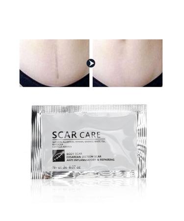 Scald & Wound Scar Removal Cream - Tummy Scars Care, 15pcs - Buy Online on GoSupps.com