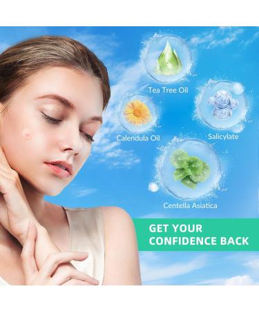 Meegoo Original Hydrocolloid Acne Pimple Patches - 3 Packs (108 Stickers) for Zits & Blemishes | Best Spot Stickers for Clear Skin - Buy Online on GoSupps.com