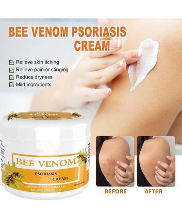 RENTANAC Bee Venom Psoriasis Cream Bee Venom Cream Psoriasis Cream New Zealand Bee Venom Cream Honey Bee Psoriasis Cream for Women Men - Buy Online on GoSupps.com