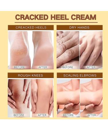 Coconut Cracked Heel Repair Cream Coconut Foot Cream For Cracked Heels & Dry Skin Foot Care Cream With Coconut Oil Callus Remover Nourishes Soften For Hand & Feet And Body - Buy Online on GoSupps.com