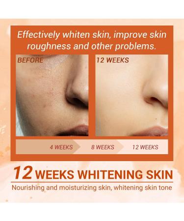 Aobenz Spot Remover for Face Dark Spot Remover for Face Anti Spot Serum Dark Spot Correcting Serum Skin Whitening Spot Treatment Freckle Remover Sun Spot Dark Spot Cream Brightening Serum 50ml - Buy Online on GoSupps.com