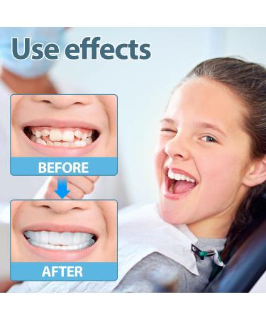 Buy 2 Pairs of Cosmetic Veneers Teeth - Top & Bottom Whitening Dentures with Box & Pincers for Bad Teeth - International Shipping Available - Buy Online on GoSupps.com