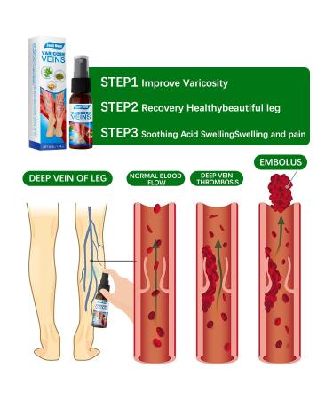 2 Pieces Veinhealing Varicose Vein Treatment Spray | Soothing Relief for Legs | Effective Varicose Vein Spray - Buy Online on GoSupps.com