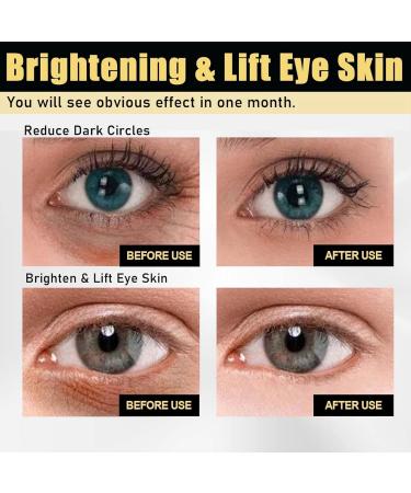 Instant Firming Eye Cream Instant Eye Bag Removal Eye Bag Cream Eye Tightening Cream Instant Diminishing Deep Wrinkles Dark Circles Face Tightener Skin Firming Anti Aging Anti Wrinkle Eye Tightener - Buy Online on GoSupps.com