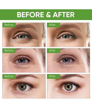 ALSTEN Anti Wrinkle Eye Cream - Reduce Dark Circles & Puffiness, Firm & Lift Skin - 0.5 fl. Oz - Buy Online on GoSupps.com