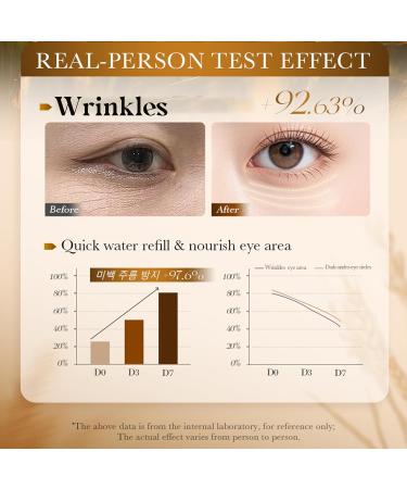 AKARY Roll on Eye Cream with 70% Rice Essence Extract Moisturize Tighten Tender Triple Roll & Glow Massage Head Under Roller Cream for Elasticity Wrinkles Puffiness Fine Lines-Korean Eye Cream - Buy Online on GoSupps.com