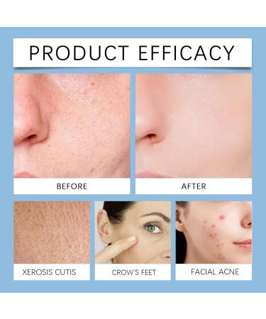 Facial Peeling Pads with Salicylic Acid - Gentle Exfoliating 70 Pads for Smooth Skin Texture Unclog Pores Hydration Boost Daily Facial Treatment for All Skin Types (S Centella*1) Centella*1 70 Count (Pack of 1) - Buy Online on GoSupps.com