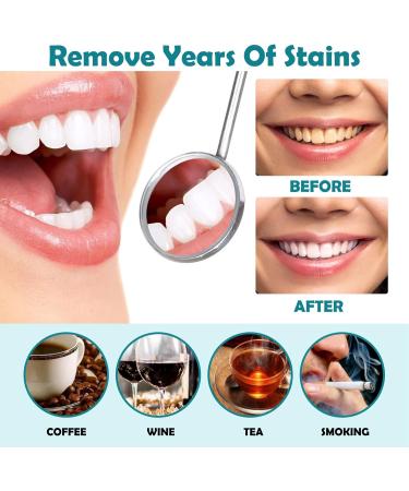 Uptight White Instant Whitening Tooth Paint - Teeth Cleaning Serum for Stain Removal and Teeth Whitening - Buy Online on GoSupps.com