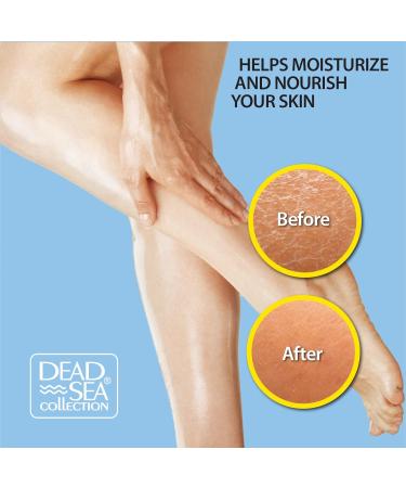 Dead Sea Collection Body Oil for Dry Skin | Coconut & Vitamin E Moisturizer | Anti-Aging Skin Elasticity Support (4 fl.oz) - International Shipping Available - Buy Online on GoSupps.com